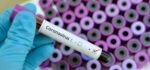 Coronavirus Antibody Test