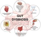 Intestinal Dysbiosis